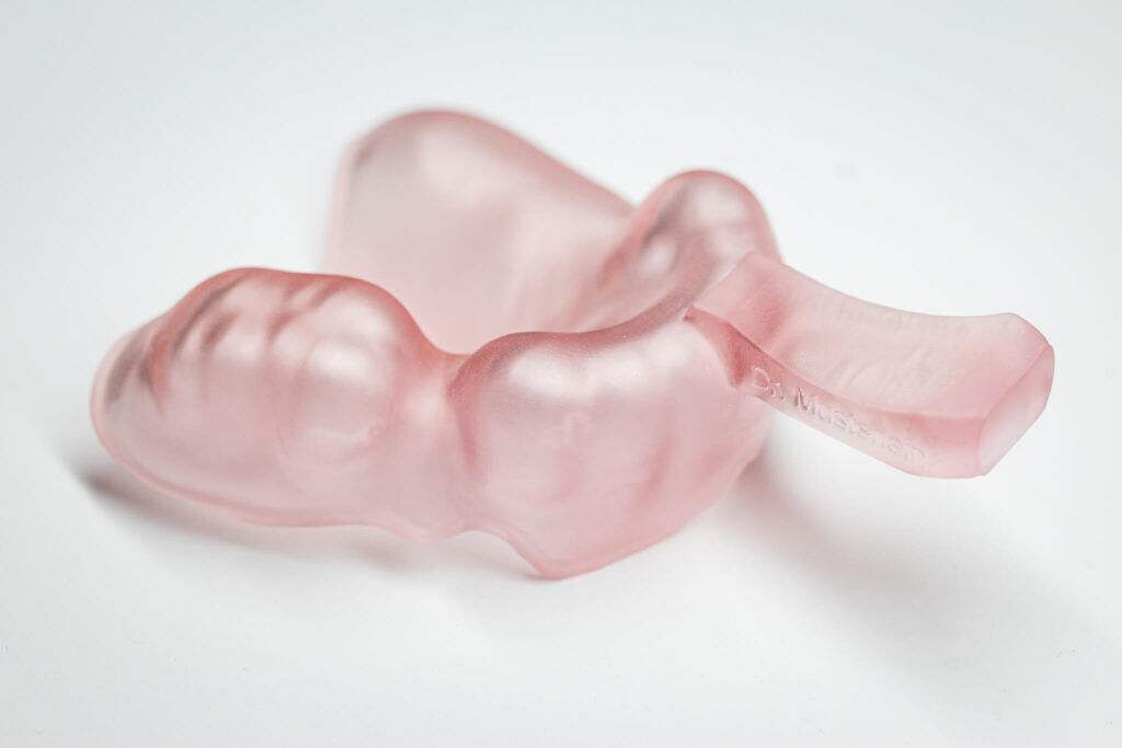 Abformlöffel gedruckt