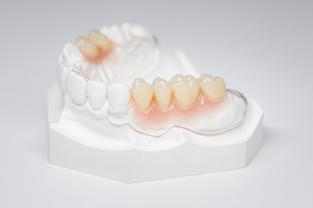 Transparente Prothese